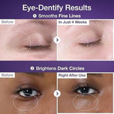 کرم دور چشم نامبوزین شماره 9 با ترکیب رتینول و NAD+ حجم 10 میل اصلی و اورجینال